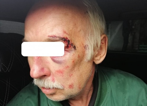 В Воронеже грабители в масках с пистолетам пробрались в дом к пенсионерам