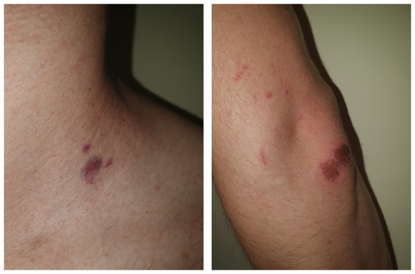 &laquo;Стреляли дважды&raquo;. Появились новые подробности конфликта в Северном лесу.
