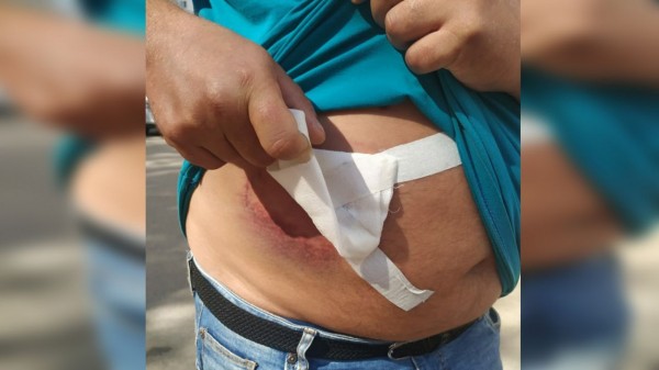 &laquo;Стреляли дважды&raquo;. Появились новые подробности конфликта в Северном лесу.
