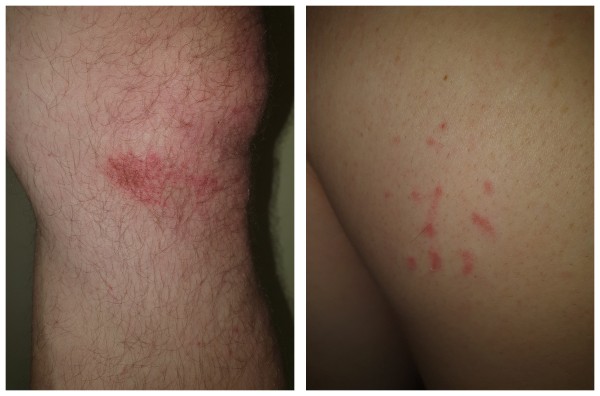 &laquo;Стреляли дважды&raquo;. Появились новые подробности конфликта в Северном лесу.
