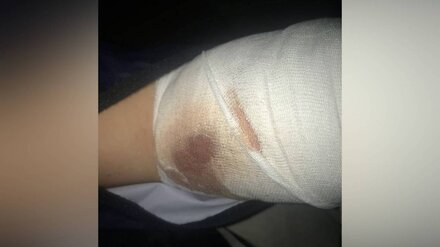 &laquo;Много крови и шок&raquo;. Раненый школьник рассказал о стрельбе в микрорайоне Воронежа