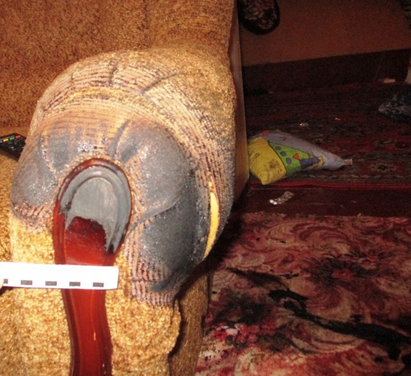 Около 70% ожогов тела получила женщина, которую облил дизелем и поджёг супруг