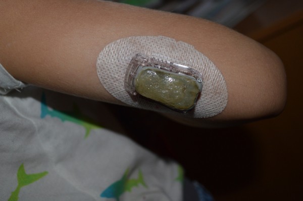 Несладкое детство. Как инсулинозависимый мальчик из Воронежской области борется с диабетом