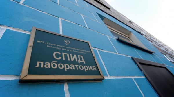 В 2021 году число случаев ВИЧ в Воронежской области снизилось почти на 16%