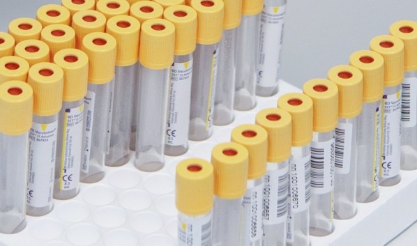 Роспотребнадзор: Лечившимся от коронавируса 7 и более дней не потребуется тест для выписки